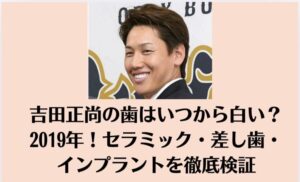 吉田正尚の歯はいつから白い？2019年！セラミック・差し歯・インプラントを検証
